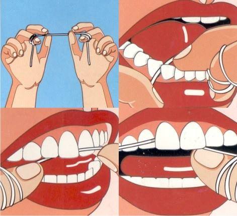 Calvo Chillido De Dios Los beneficios del hilo dental] - Clínica Dental Sonríe